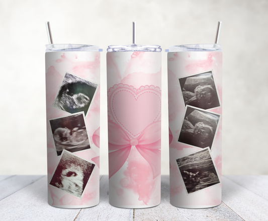 Three tumblers with ultrasound images and a pink butterfly design on a white background